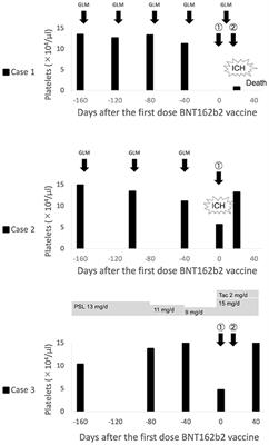 Potential Triggers for Thrombocytopenia and/or Hemorrhage by the BNT162b2 Vaccine, Pfizer-BioNTech